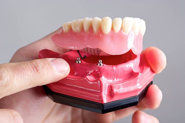 Dental model and consultation