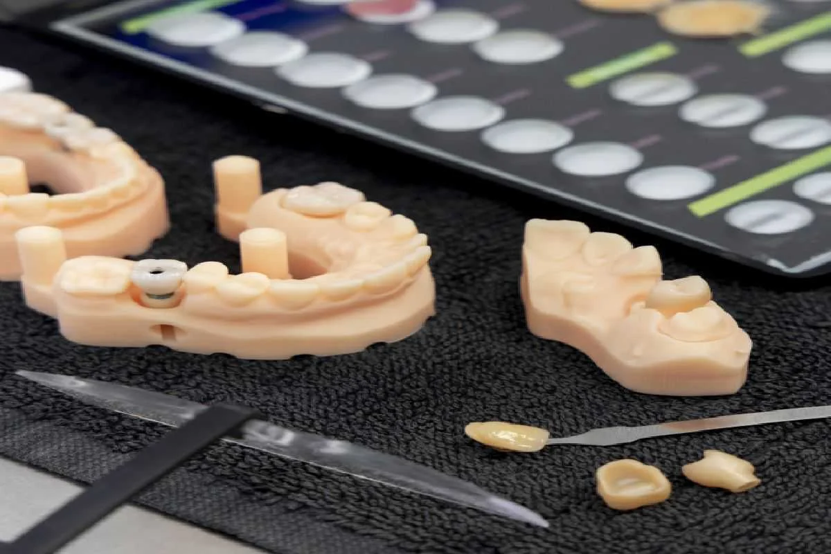 dental implant vs dental implants